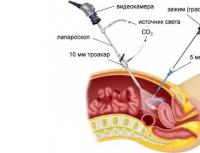 卵管閉塞：原因、診断、治療
